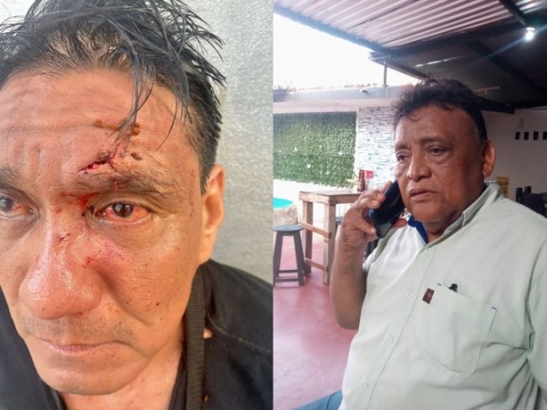 Golpean en Tehuantepec al periodista Cristian Hernández&nbsp;Espinosa